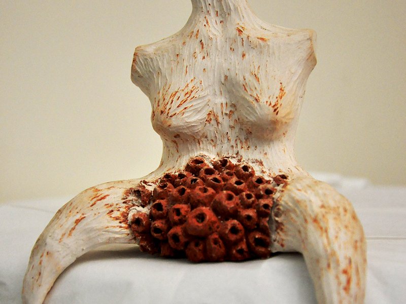 cavity